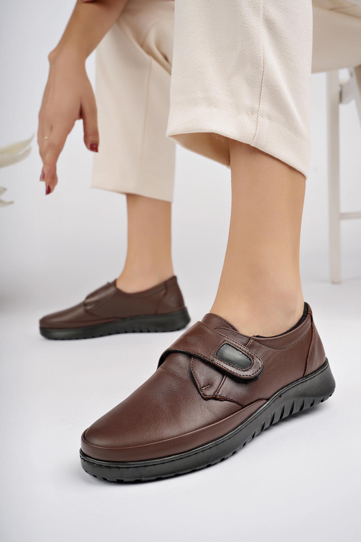 ARCH Garantili Ortopedik Taban Topuk Dikeni Hakiki Deri Kadın Ayakkabı - Görsel 6