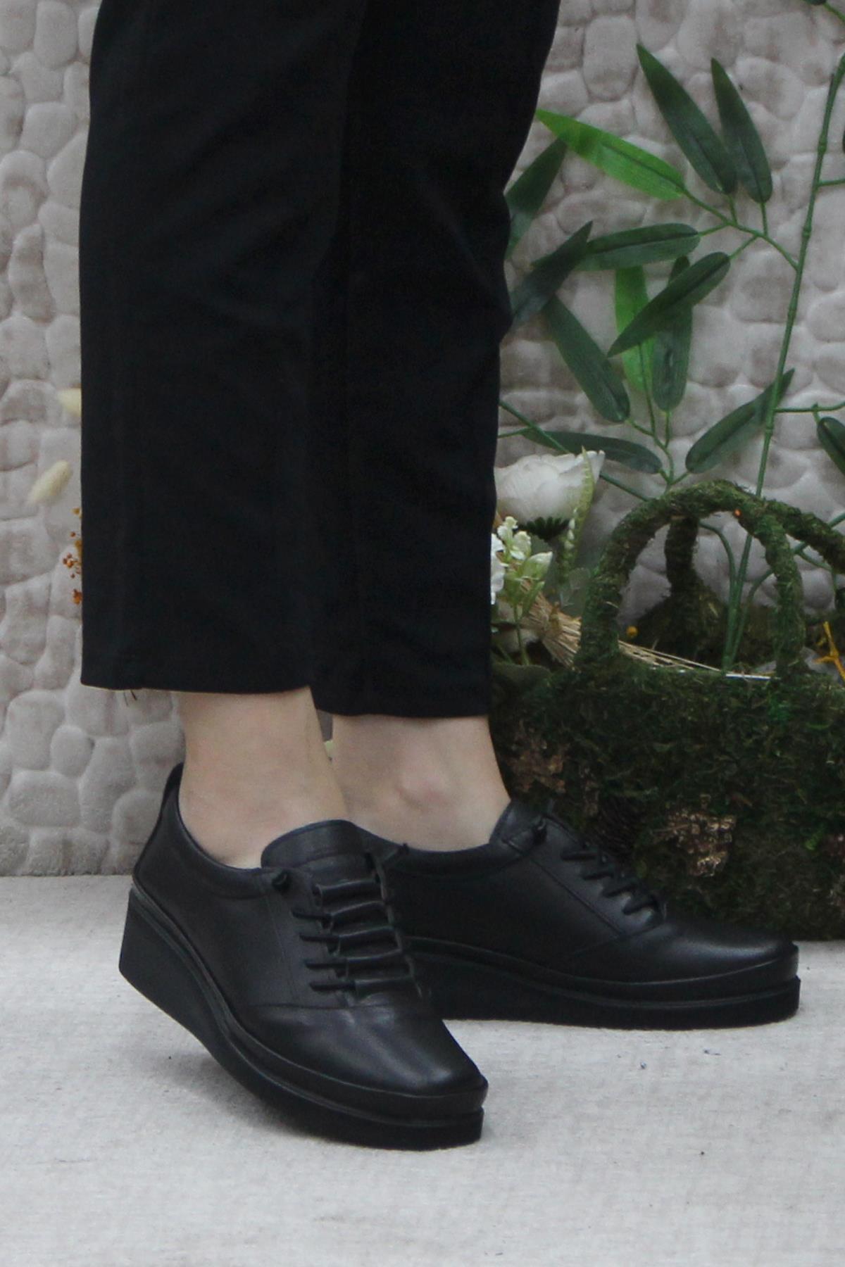 4299 Siyah Hakiki Deri Lastik Bağçıklı Yumuşak Kadın Ayakkabı - Görsel 2