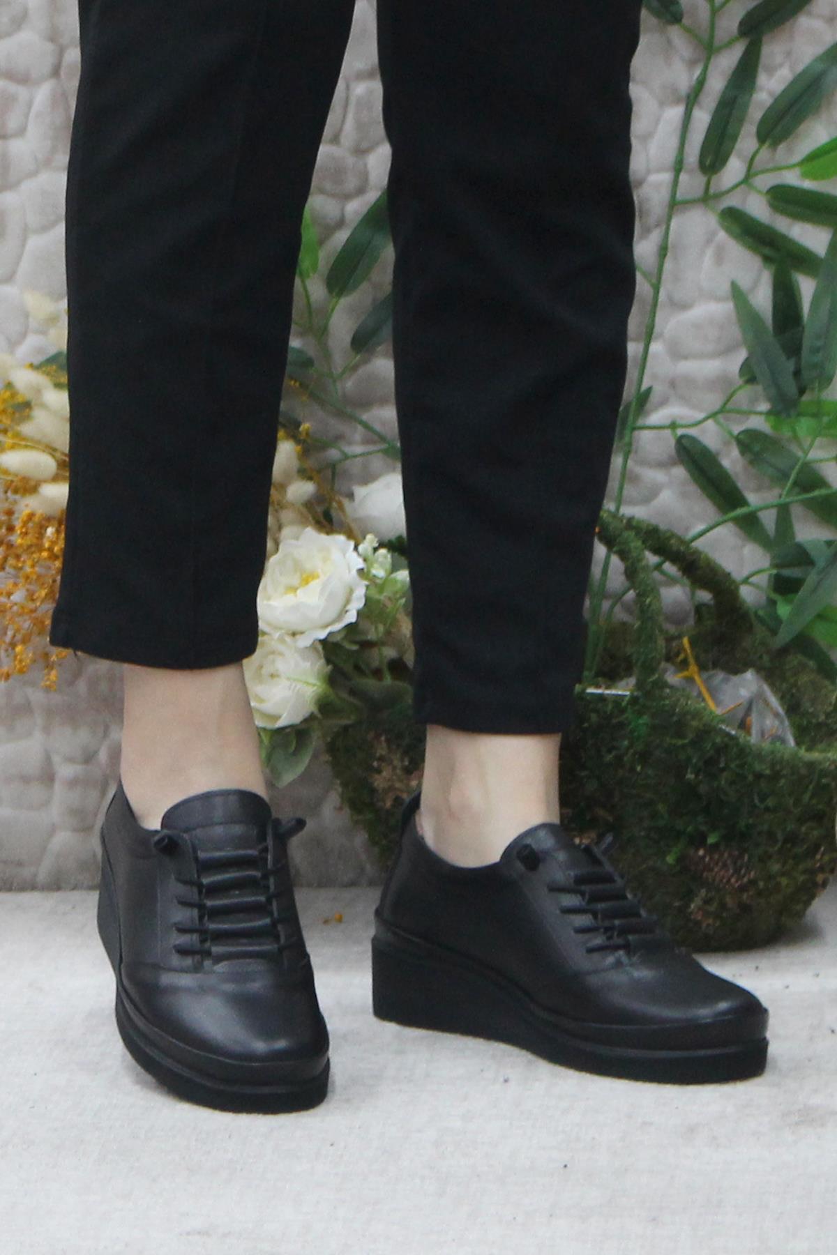 4299 Siyah Hakiki Deri Lastik Bağçıklı Yumuşak Kadın Ayakkabı - Görsel 3